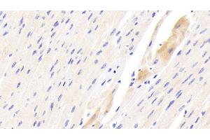 Detection of TSPO in Human Cardiac Muscle Tissue using Polyclonal Antibody to Translocator Protein (TSPO) (TSPO 抗体  (AA 1-169))