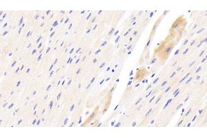 Immunohistochemistry (IHC) image for anti-Peripheral-Type Benzodiazepine Receptor (TSPO) (AA 1-169) antibody (ABIN7436717)