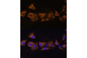 Immunofluorescence (IF) image for anti-ATPase, Na+/K+ Transporting, beta 2 Polypeptide (ATP1B2) (AA 68-290) antibody (ABIN6137310)