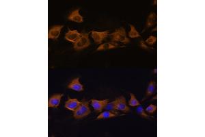Immunofluorescence analysis of C6 cells using B2 Rabbit pAb (ABIN6127467, ABIN6137310, ABIN6137311 and ABIN6225253) at dilution of 1:100. (ATP1B2 抗体  (AA 68-290))