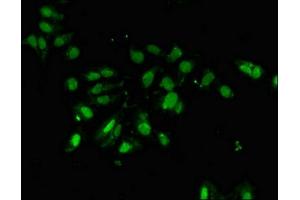Immunofluorescent analysis of Hela cells using ABIN7162710 at dilution of 1:100 and Alexa Fluor 488-congugated AffiniPure Goat Anti-Rabbit IgG(H+L) (PCID2 抗体  (AA 2-250))