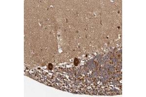 Immunohistochemical staining of human cerebellum with MDP-1 polyclonal antibody  shows strong cytoplasmic positivity in Purkinje cells.