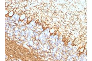 Immunohistochemistry (IHC) image for anti-Neurofilament, Heavy Polypeptide (NEFH) antibody (ABIN6940180)