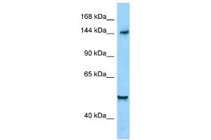 WB Suggested Anti-DIAPH1 Antibody Titration: 1. (DIAPH1 抗体  (C-Term))