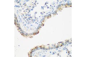 Immunohistochemistry of paraffin-embedded mouse lung using IGF2BP3 antibody (ABIN5972501) at dilution of 1/200 (40x lens). (IGF2BP3 抗体)