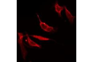 Immunofluorescence (fixed cells) (IF/ICC) image for anti-Solute Carrier Family 17 (Anion/Sugar Transporter), Member 2 (SLC17A2) (N-Term) antibody (ABIN6258401)