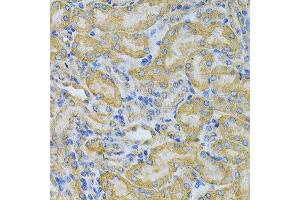 Immunohistochemistry of paraffin-embedded mouse kidney using PGK1 Antibody. (PGK1 抗体  (AA 1-417))