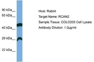 Host: Rabbit Target Name: RCAN2 Sample Type: COLO205 Whole Cell lysates Antibody Dilution: 1. (RCAN2 抗体  (Middle Region))