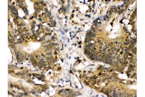 Immunohistochemistry (IHC) image for anti-Mitogen-Activated Protein Kinase Kinase 3 (MAP2K3) (AA 311-347), (C-Term) antibody (ABIN3043874)