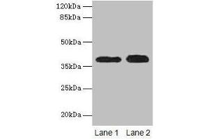 Western blot All lanes: CTSL antibody at 12 μg/mL Lane 1: A549 whole cell lysate Lane 2: HepG2 whole cell lysate Secondary Goat polyclonal to rabbit IgG at 1/10000 dilution Predicted band size: 38 kDa Observed band size: 38 kDa (Cathepsin L 抗体  (AA 114-333))