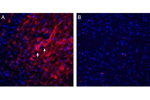 Expression of Homer1 in rat parietal cortex. (HOMER1 抗体  (Intracellular))