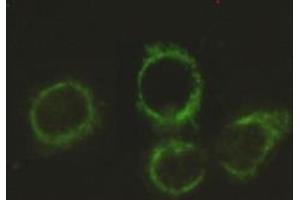 Immunocytochemistry stain of Hela using Pyruvate Dehydrogenase E2 mouse mAb (1:300). (CYB561 抗体)