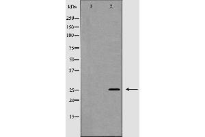 Western blot analysis of NGF beta expression in Jurkat cells,The lane on the left is treated with the antigen-specific peptide. (Nerve Growth Factor 抗体  (Internal Region))