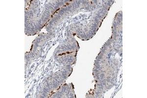 Immunohistochemical staining of human fallopian tube with DNAH5 polyclonal antibody  shows distinct positivity in the cilia at 1:10-1:20 dilution. (Dnah5 抗体)