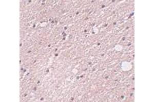 Immunohistochemistry of FRMPD4 in human brain tissue with FRMPD4 antibody at 5 μg/ml. (FRMPD4 抗体  (Center))