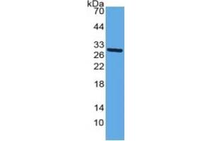 WB of Protein Standard: different control antibodies against Highly purified E. (alpha 2 Macroglobulin ELISA 试剂盒)