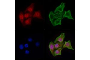 ABIN6263956 and ABIN6268907 staining HepG2 cells by IF/ICC.