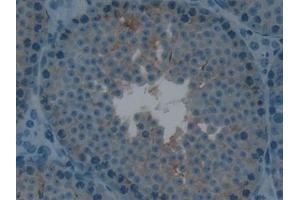 Immunohistochemistry (IHC) image for anti-Lymphotoxin beta Receptor (TNFR Superfamily, Member 3) (LTBR) (AA 128-395) antibody (ABIN7439096)