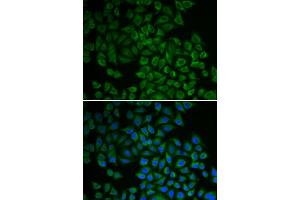 Immunofluorescence analysis of HeLa cell using SGK1 antibody. (SGK1 抗体)
