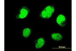Immunofluorescence of monoclonal antibody to PAX7 on HeLa cell. (PAX7 抗体  (AA 411-520))