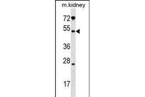 GALNT13 Antibody (Center) (ABIN1539681 and ABIN2849709) western blot analysis in mouse kidney tissue lysates (35 μg/lane). (GALNT13 抗体  (AA 252-281))