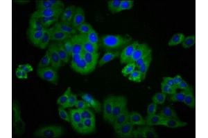 Immunofluorescence staining of HepG2 cells with ABIN7150072 at 1:233, counter-stained with DAPI.