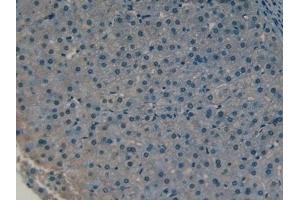 Detection of CLL1 in Human Liver Tissue using Polyclonal Antibody to Collectin Liver 1 (CLL1)