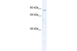 Western Blotting (WB) image for anti-Sirtuin 1 (SIRT1) antibody (ABIN2460449) (SIRT1 抗体)