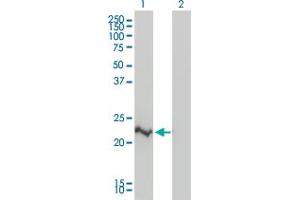 Western Blotting (WB) image for anti-CASP2 and RIPK1 Domain Containing Adaptor with Death Domain (CRADD) (AA 1-199) antibody (ABIN563759)