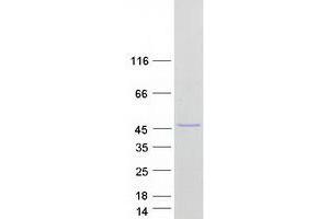Western Blotting (WB) image for Cysteine Conjugate-beta Lyase 2 (CCBL2) (Transcript Variant 1) protein (Myc-DYKDDDDK Tag) (ABIN2713273)