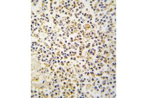 Formalin-fixed and paraffin-embedded human kideny tissue reacted with ALDH1A3 antibody (N-term), which was peroxidase-conjugated to the secondary antibody, followed by DAB staining. (ALDH1A3 抗体  (N-Term))