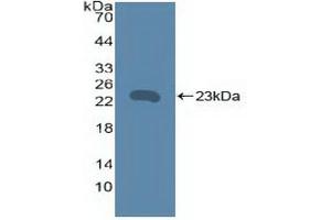 Western blot analysis of recombinant Human TNFRSF5. (CD40 抗体  (AA 26-187))