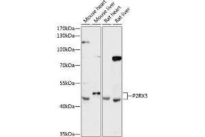 Western blot analysis of extracts of various cell lines, using P2RX3 antibody (ABIN6132577, ABIN6145111, ABIN6145114 and ABIN6216793) at 1:3000 dilution. (P2RX3 抗体  (AA 328-397))