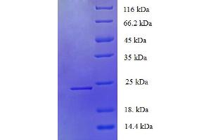 SDS-PAGE (SDS) image for Plasminogen Activator, Urokinase Receptor (PLAUR) (AA 1-178), (partial) protein (His tag) (ABIN5710115) (PLAUR Protein (AA 1-178, partial) (His tag))