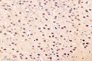 Immunohistochemistry (Paraffin-embedded Sections) (IHC (p)) image for anti-Nitric Oxide Synthase 1 (Neuronal) Adaptor Protein (NOS1AP) antibody (ABIN7074844)