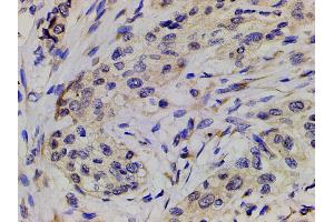Immunohistochemistry (IHC) image for anti-Phosphoinositide 3 Kinase, p85 alpha (PI3K p85a) (pTyr607) antibody (ABIN6256775)
