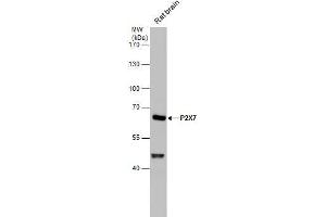 WB Image P2X7 antibody detects P2X7 protein by western blot analysis. (P2RX7 抗体  (Center))