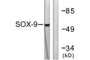 Western blot analysis of extracts from 293 cells, treated with PBS 60', using SOX9 (Ab-181) Antibody. (SOX9 抗体  (AA 147-196))
