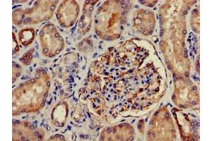 Immunohistochemistry of paraffin-embedded human kidney tissue using ABIN7169035 at dilution of 1:100 (PRKD3 抗体  (AA 326-510))