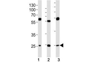 Western blot analysis of lysate from (1) HeLa, (2) HepG2 and (3) U-2OS cell line using TFAM antibody at 1:1000. (TFAM 抗体  (AA 216-246))