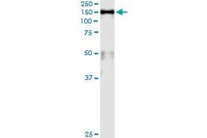 Immunoprecipitation (IP) image for anti-Minichromosome Maintenance Complex Component 2 (MCM2) (AA 805-904) antibody (ABIN561759)