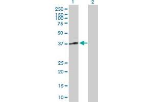 Western Blotting (WB) image for anti-Fc Fragment of IgG, Low Affinity IIIa, Receptor (CD16a) (FCGR3A) (AA 1-290) antibody (ABIN515571)