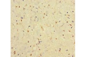 Immunohistochemistry of paraffin-embedded human smooth muscle tissue using ABIN7156578 at dilution of 1:100 (IFNAR2 抗体  (AA 27-243))