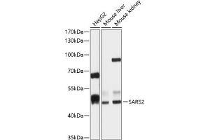 Western blot analysis of extracts of various cell lines, using S antibody (ABIN6132970, ABIN6147387, ABIN6147388 and ABIN6215904) at 1:1000 dilution. (SARS2 抗体  (AA 289-518))