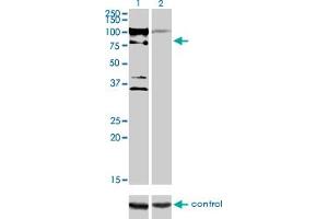 Western blot analysis of ZNF274 over-expressed 293 cell line, cotransfected with ZNF274 Validated Chimera RNAi (Lane 2) or non-transfected control (Lane 1). (ZNF274 抗体  (AA 420-530))