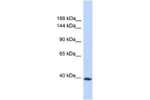 Host:  Rabbit  Target Name:  MYBPC3  Sample Type:  MCF7 Whole cell lysates  Antibody Dilution:  1. (MYBPC3 抗体  (C-Term))