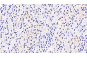 Immunohistochemistry (IHC) image for anti-Cytochrome P450, Family 2, Subfamily D, Polypeptide 6 (CYP2D6) (AA 236-472) antibody (ABIN7437350)