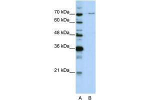 Western Blotting (WB) image for anti-PRP3 Pre-mRNA Processing Factor 3 Homolog (PRPF3) antibody (ABIN2462173) (PRPF3 抗体)