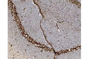 IHC analysis of FOXP1 using anti-FOXP1 antibody (ABIN7602780). (FOXP1 抗体  (C-Term))