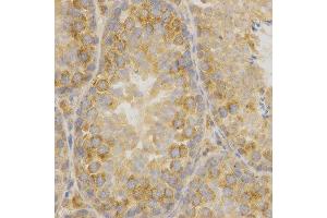 Immunohistochemistry (IHC) image for anti-Oxidized Low Density Lipoprotein (Lectin-Like) Receptor 1 (OLR1) (AA 58-273) antibody (ABIN1681162) (OLR1 抗体  (AA 58-273))